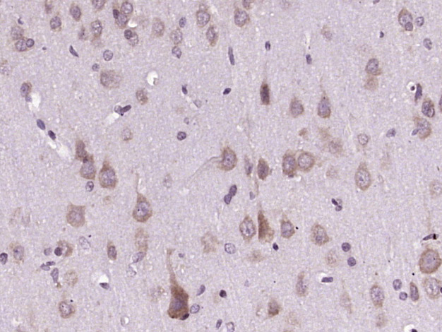 CAPRIN2 Rabbit pAb(bs-12423R)-