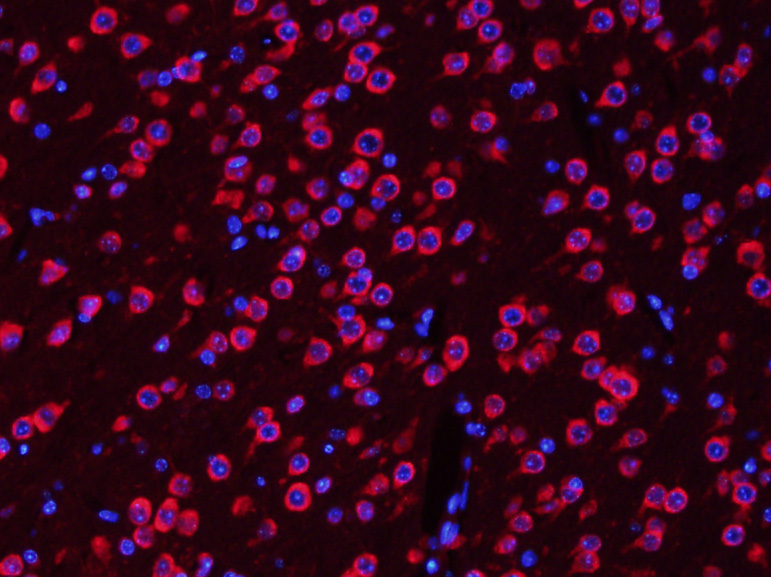 TUBB3 (Neuronal Marker) Rabbit