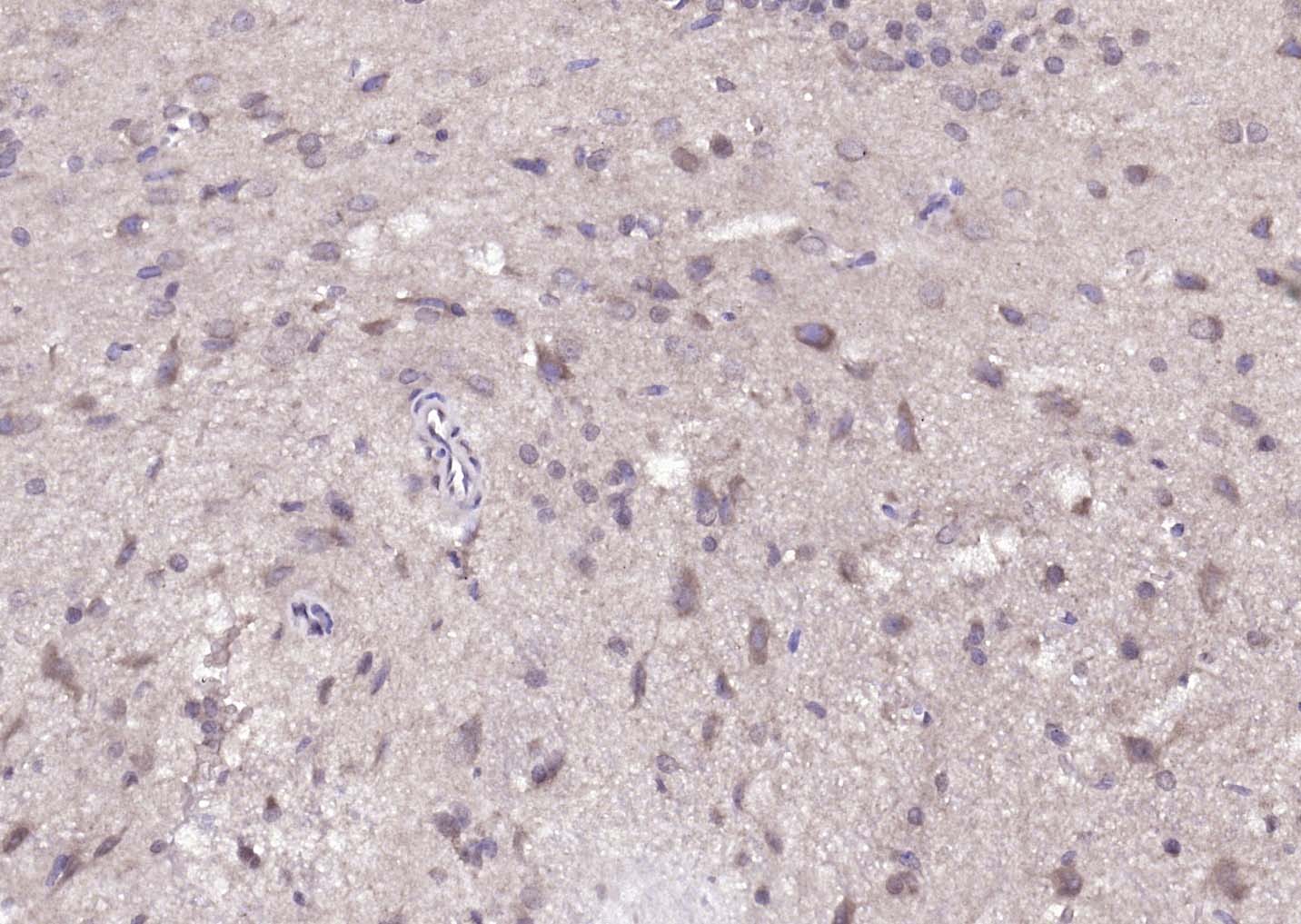 DUSP10 Rabbit pAb(bs-13035R)-5