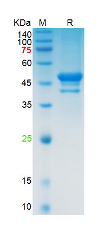 Recombinant SARS-Cov-2 N prote
