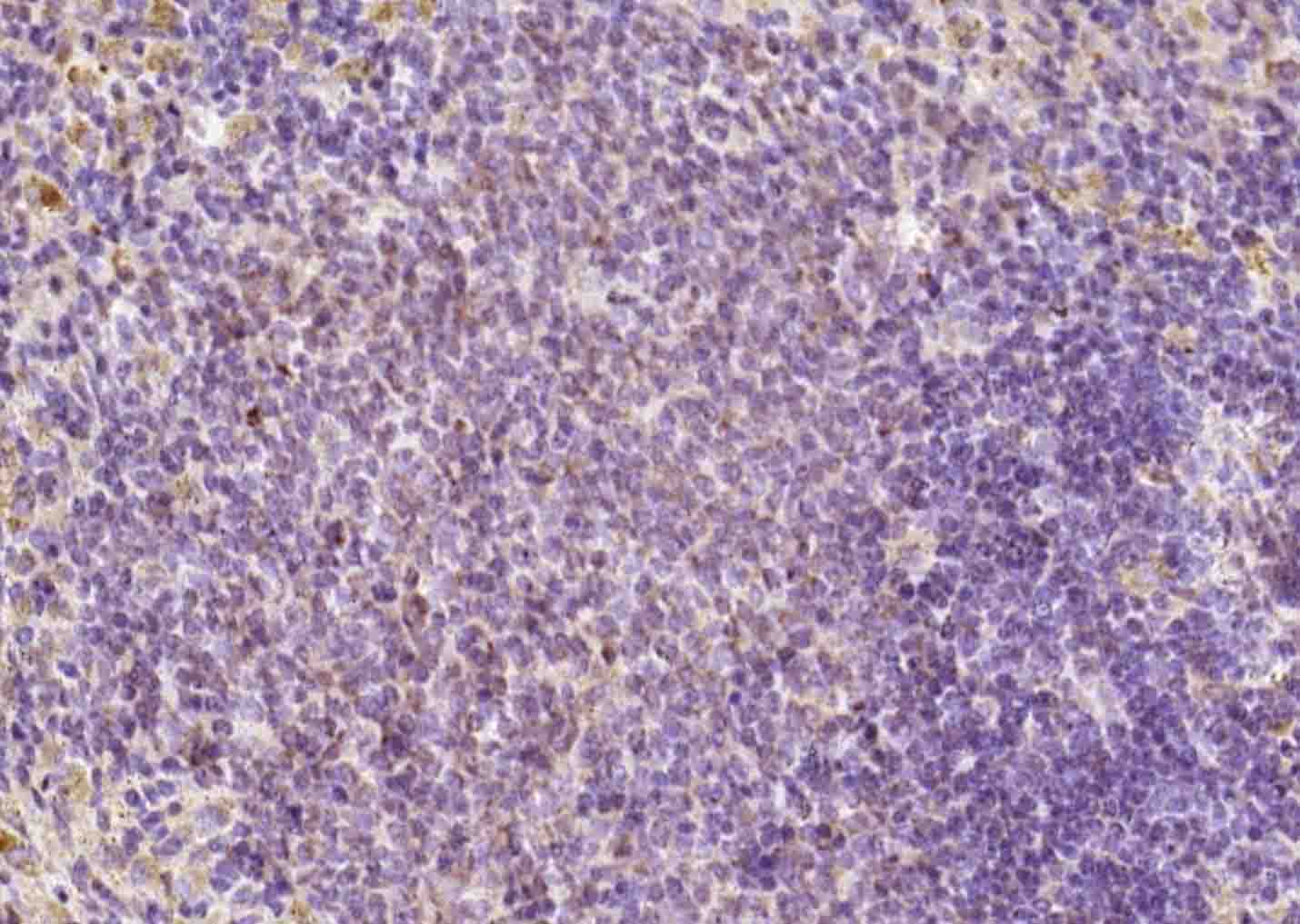 FAM46C Rabbit pAb(bs-8198R)-50