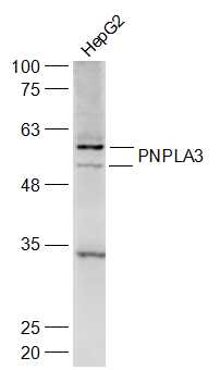 PNPLA3 Rabbit pAb(bs-12745R)-5