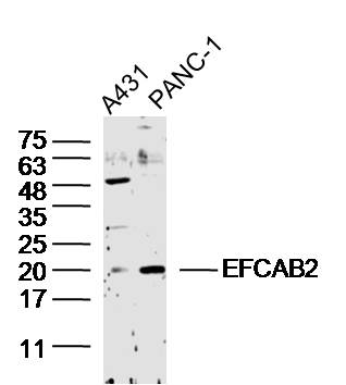 EFCAB2 Rabbit pAb(bs-14509R)-5