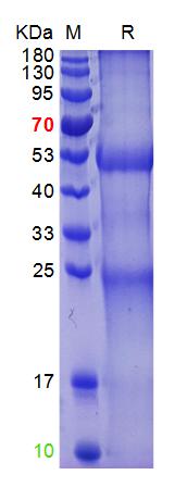 Human Rheumatoid factor(A1602P