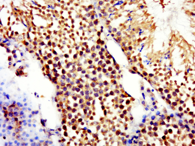 RNF16 Rabbit pAb(bs-9162R)-50u