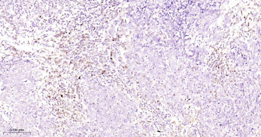 GBA Recombinant Rabbit mAb(bsm