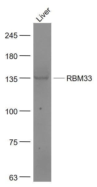 RBM33 Rabbit pAb(bs-21295R)-50