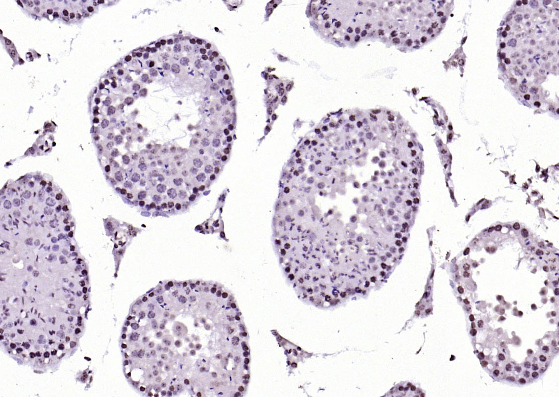 SIK1 Rabbit pAb(bs-6252R)-50ul