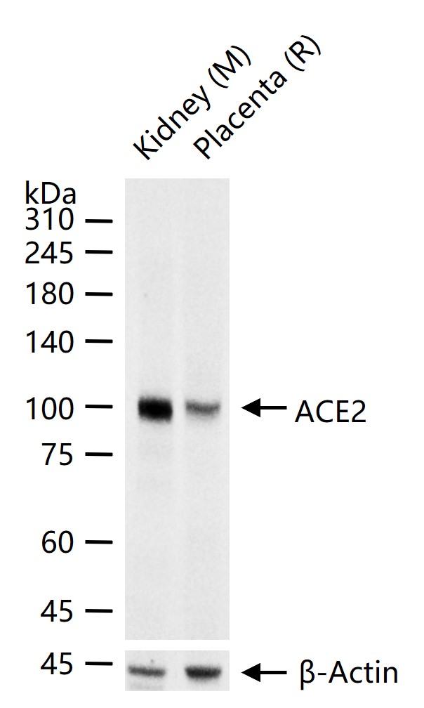 ACE2 Recombinant Rabbit mAb(bs