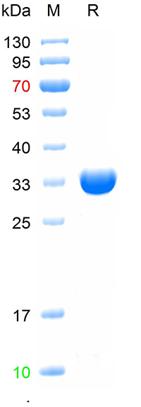 Recombinant human Nephrin, His