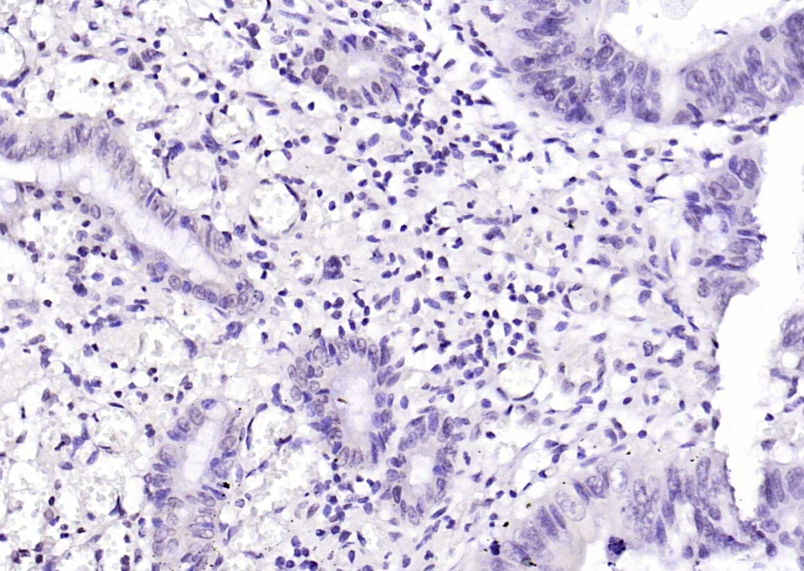 FIGNL1 Rabbit pAb(bs-9433R)-50