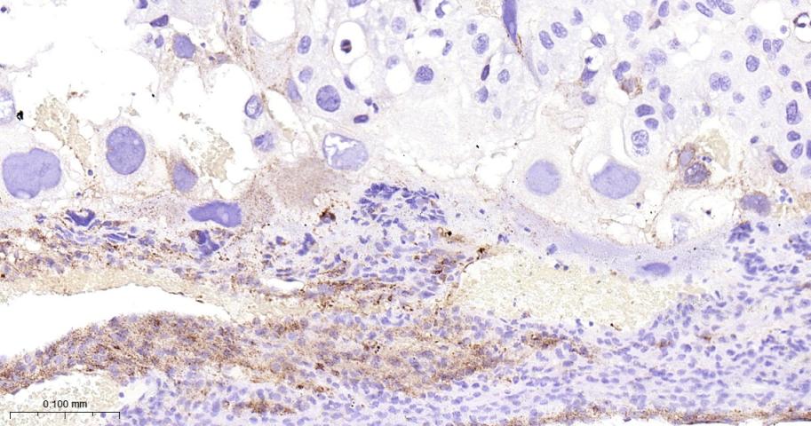 GBA Recombinant Rabbit mAb(bsm