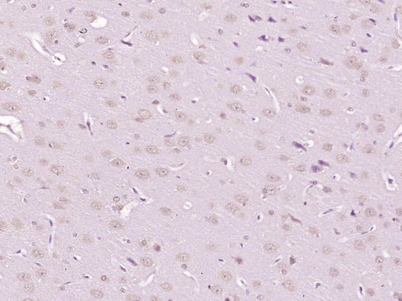 GDNF Rabbit pAb(bs-23586R)-50u