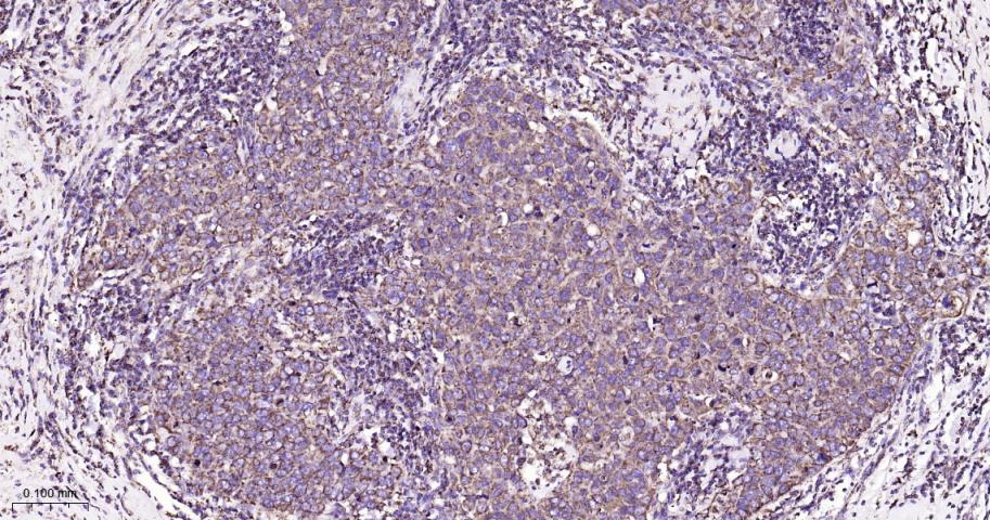 VDAC1 Recombinant Rabbit mAb, 