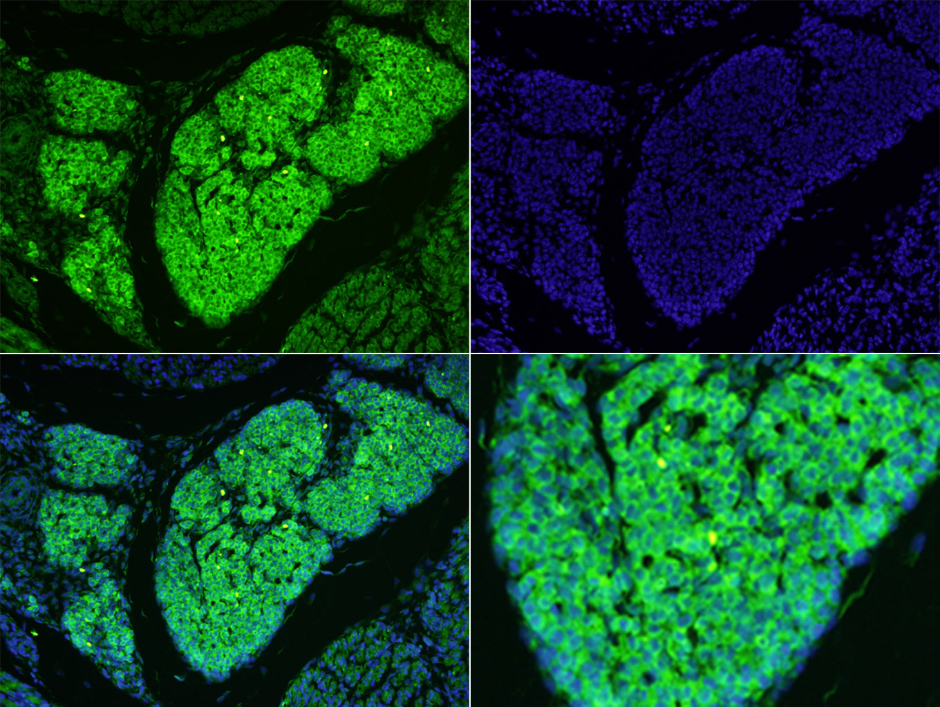 MAP1B Rabbit pAb(bs-11028R)-50