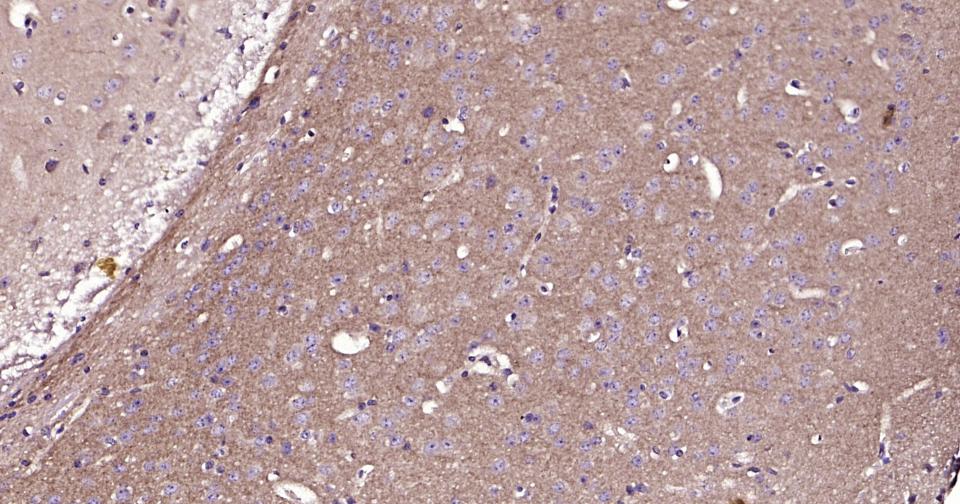 RAB5B Rabbit pAb(bs-11783R)-50