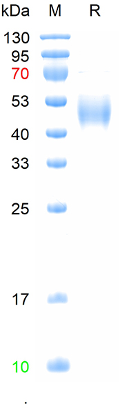 Recombinant human CD19 protein