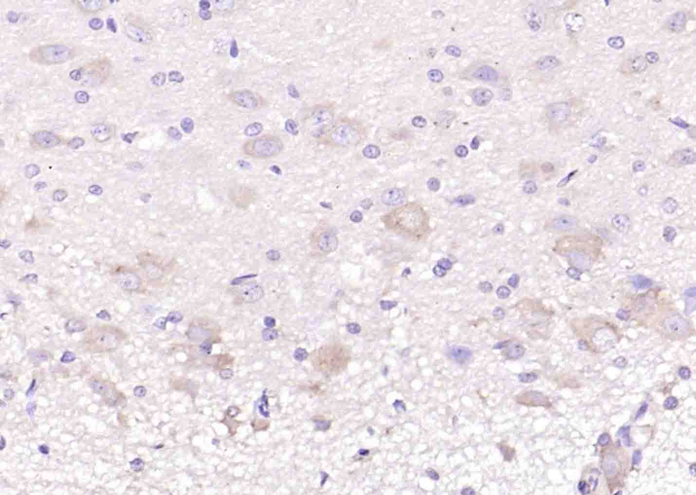 GHRH Rabbit pAb(bs-0205R)-50ul