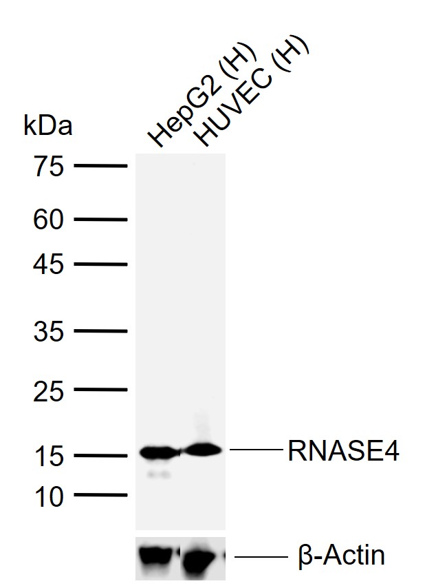 RNASE4 Rabbit pAb(bs-6583R)-50
