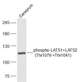 phospho-LATS1+LATS2 (Thr1079 +