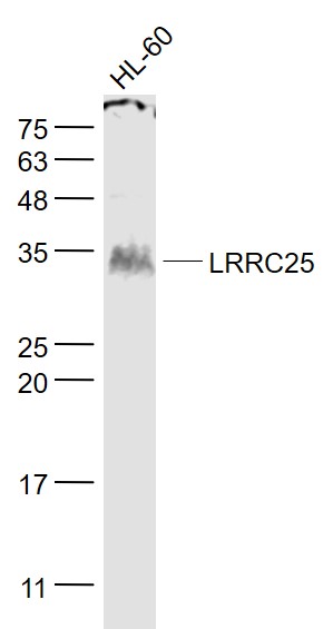 LRRC25 Rabbit pAb(bs-12339R)-5