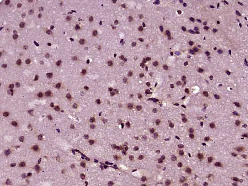 PPP3CA Rabbit pAb(bs-7381R)-50