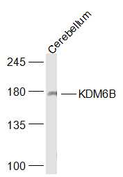 KDM6B Rabbit pAb(bs-20004R)-50