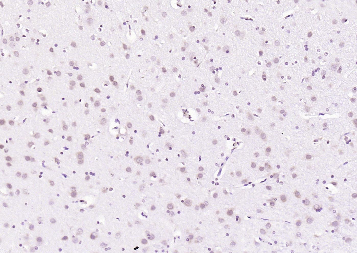 PLK1 Rabbit pAb(bs-3535R)-50ul