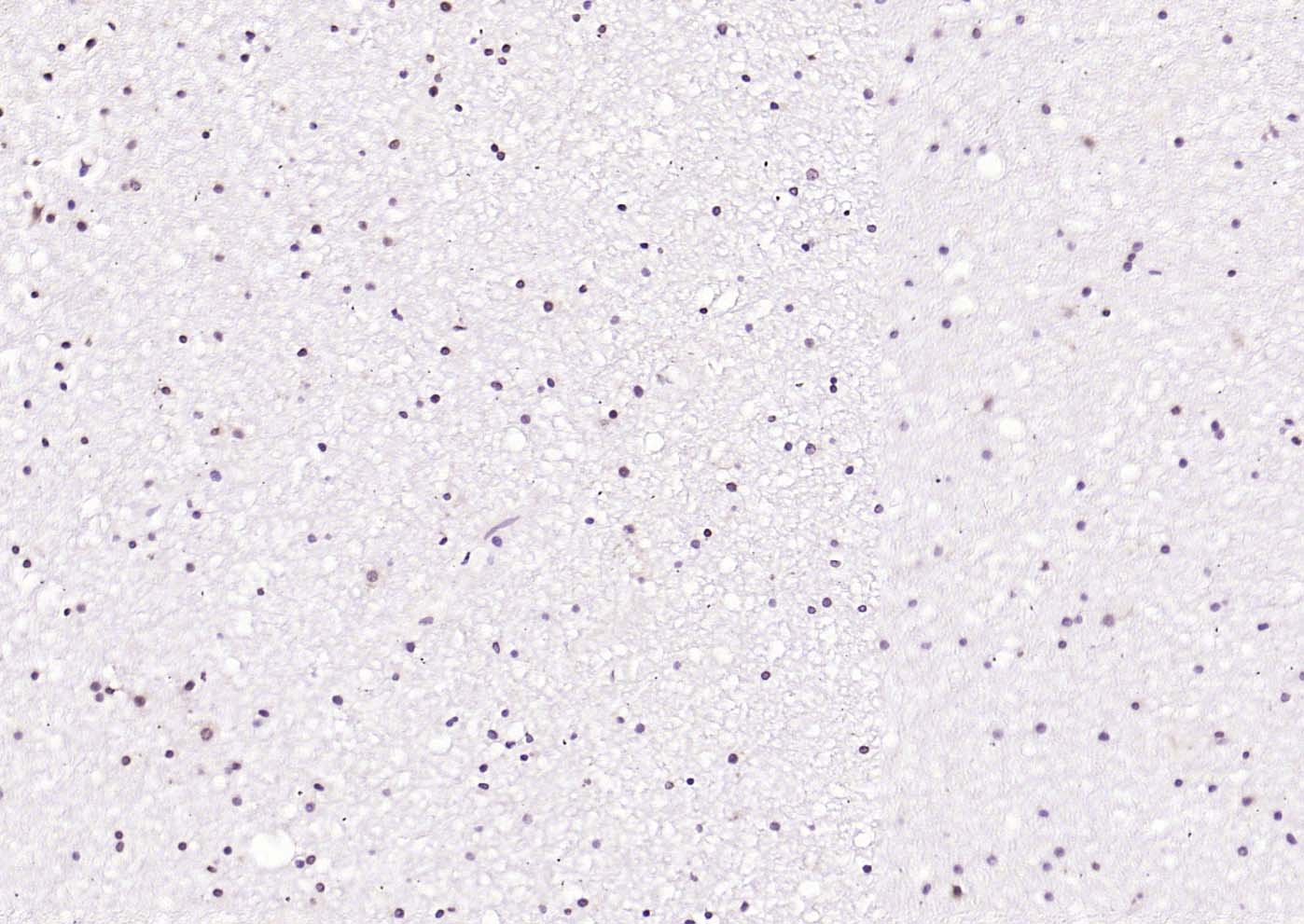 PLK1 Rabbit pAb(bs-3535R)-50ul