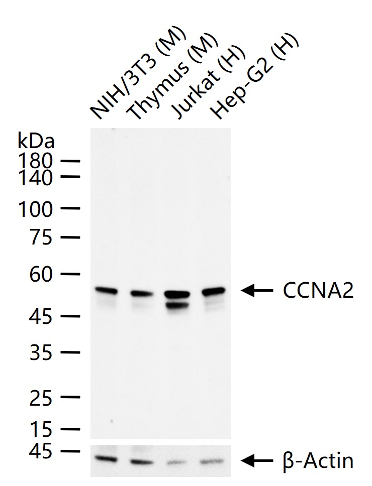CCNA2 Recombinant Rabbit mAb(b