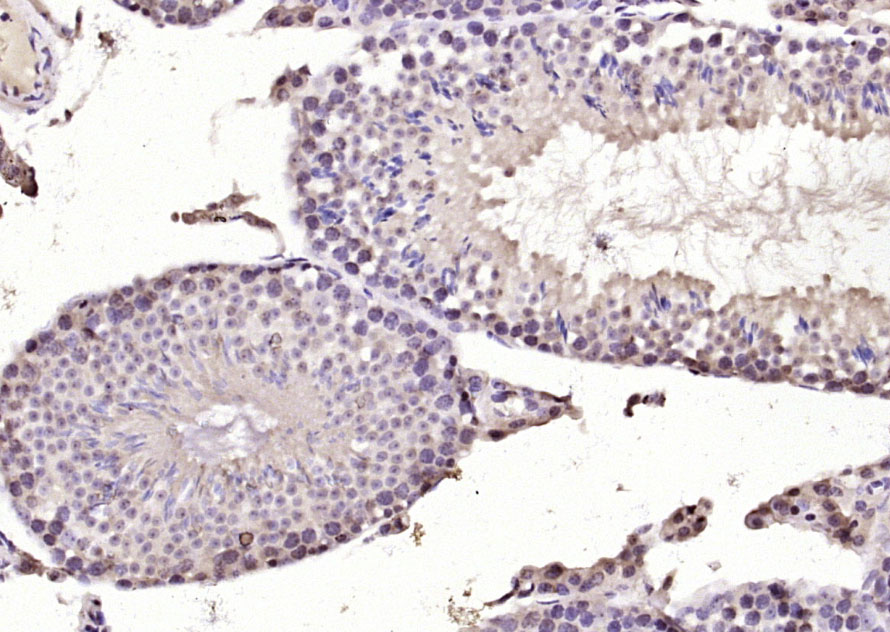 DYRK2 Rabbit pAb(bs-12332R)-50