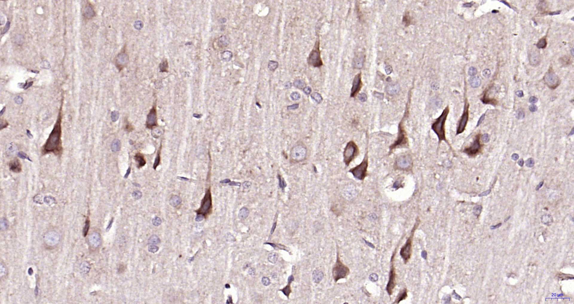 MAP1B Rabbit pAb(bs-11028R)-50