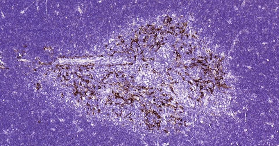 Cytokeratin 14 Recombinant Rab