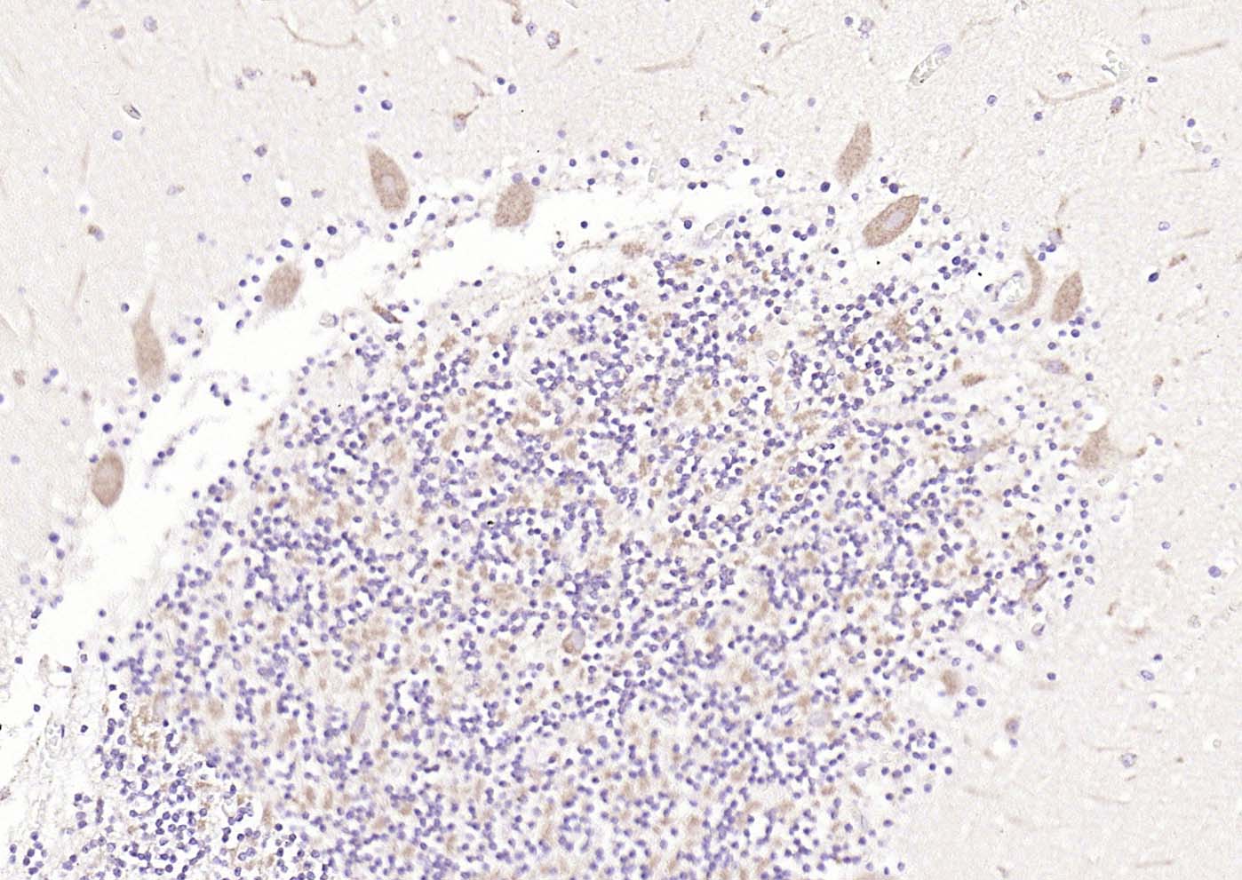 5HT7 Receptor Rabbit pAb(bs-12