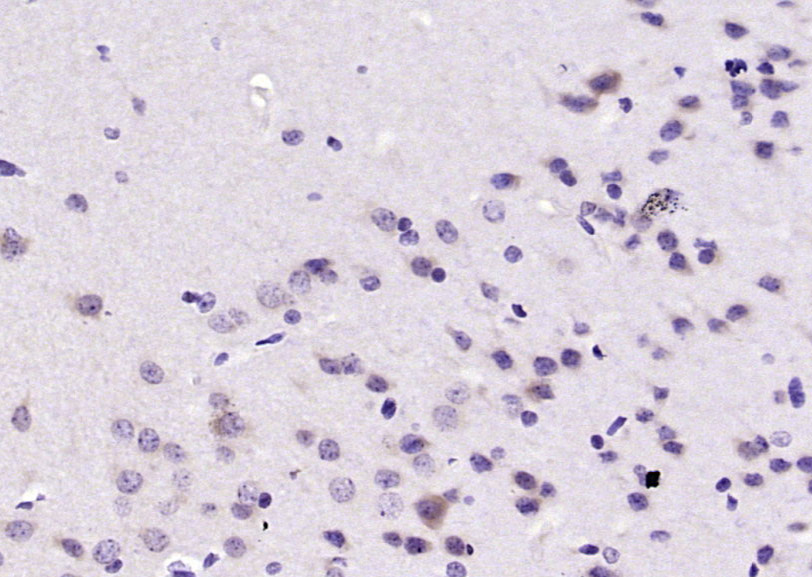 PPP2R2B/PP2A-B55 Rabbit pAb(bs