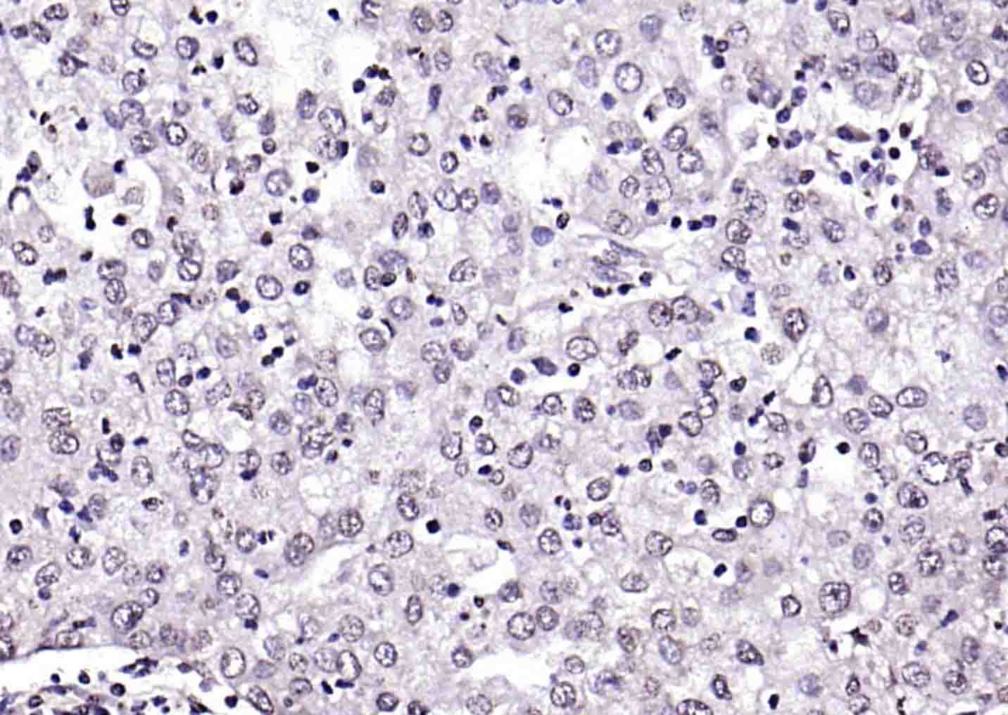 5 MethylCytosine Rabbit pAb(bs