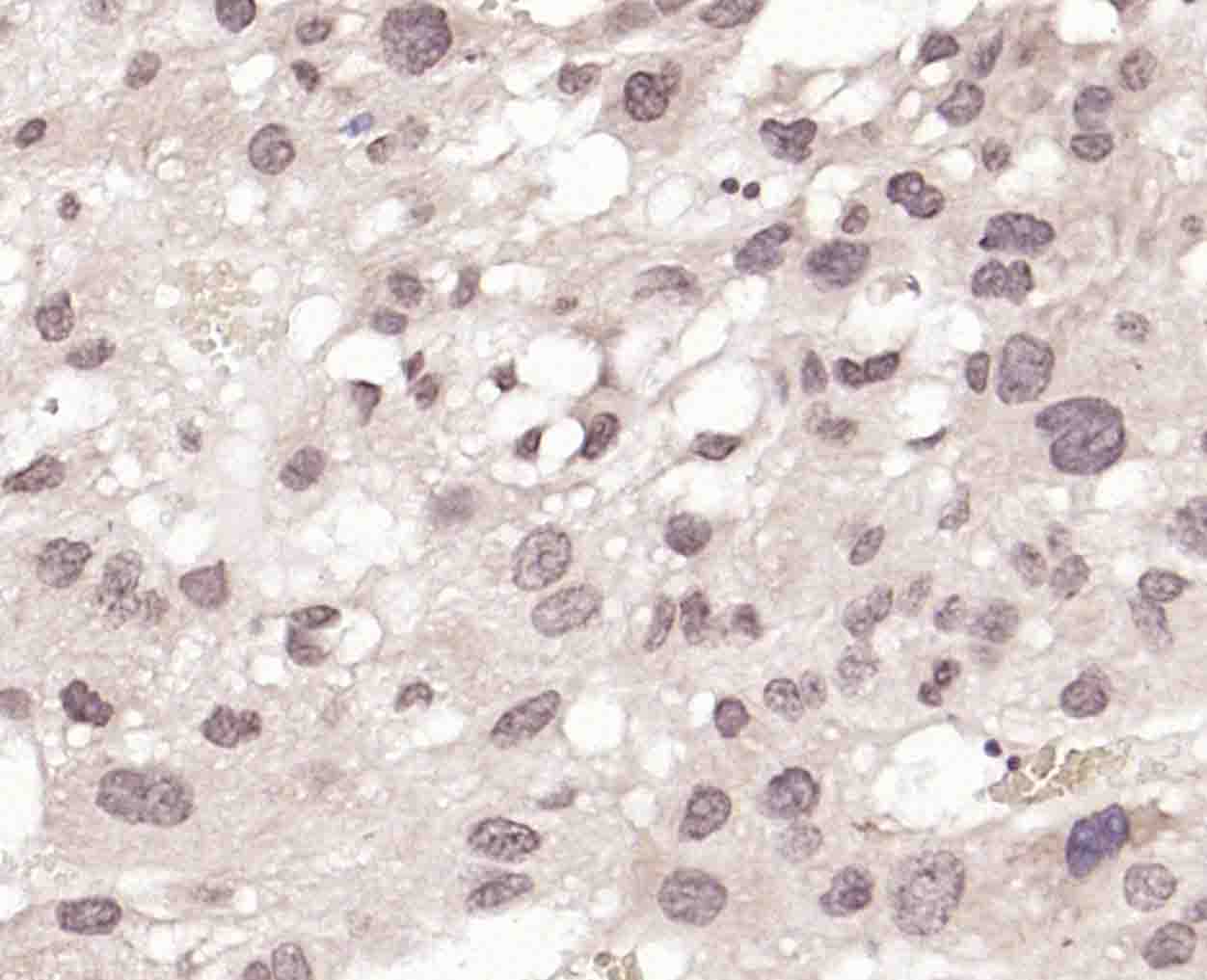 BRMS1 Rabbit pAb(bs-8686R)-50u