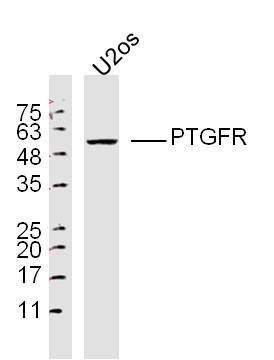 PTGFR Rabbit pAb(bs-10433R)-50