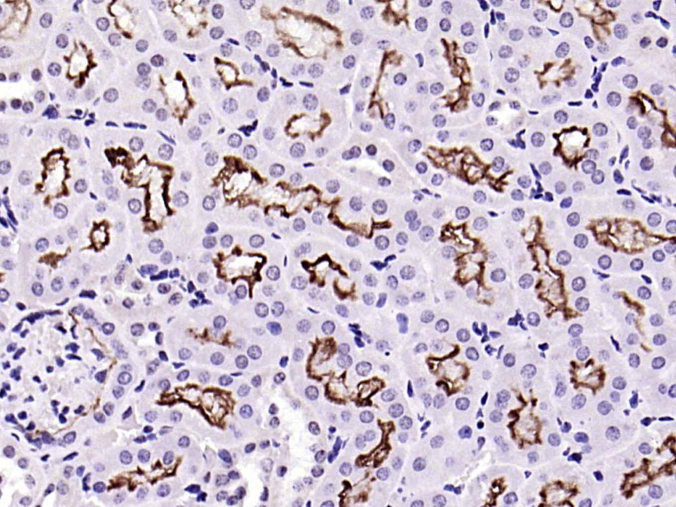 ACE2 Recombinant Rabbit mAb(bs