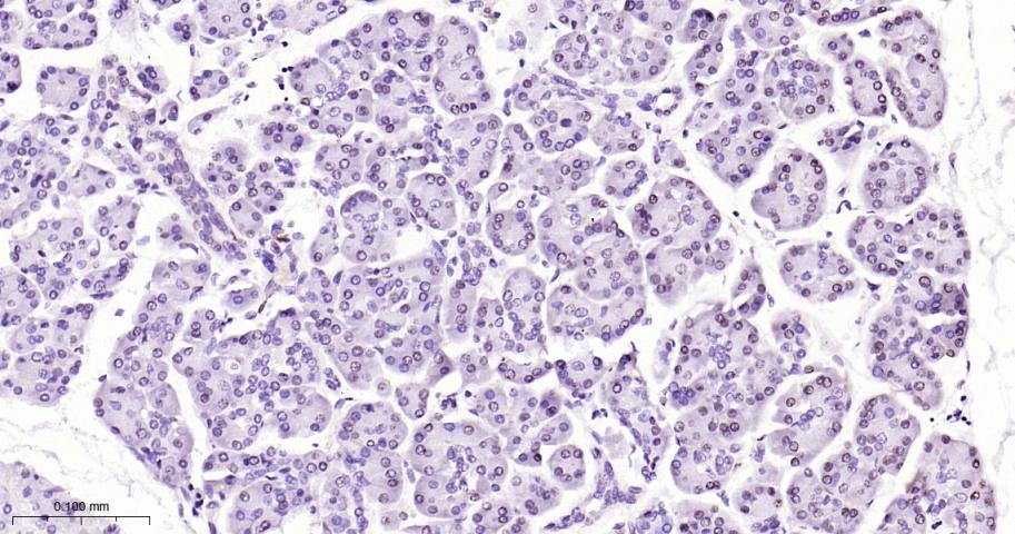 phospho-STAT3 (Tyr705) Mouse m