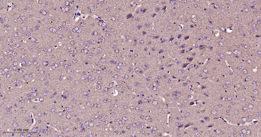 VDAC1 Recombinant Rabbit mAb, 