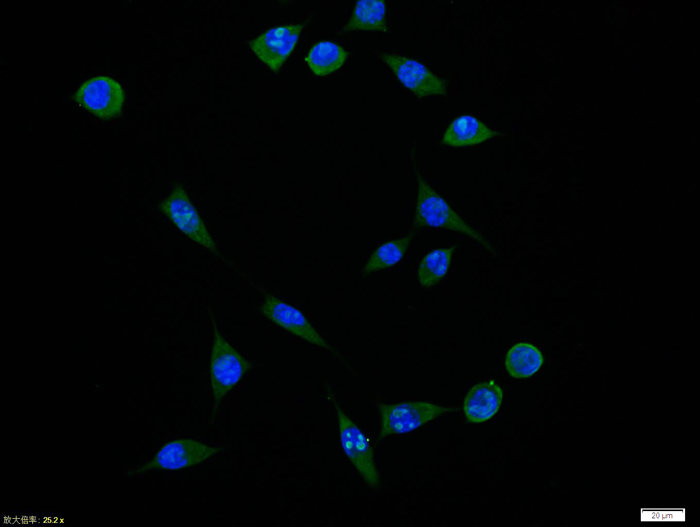 phospho-PDGFRA (Tyr849) / PDGF