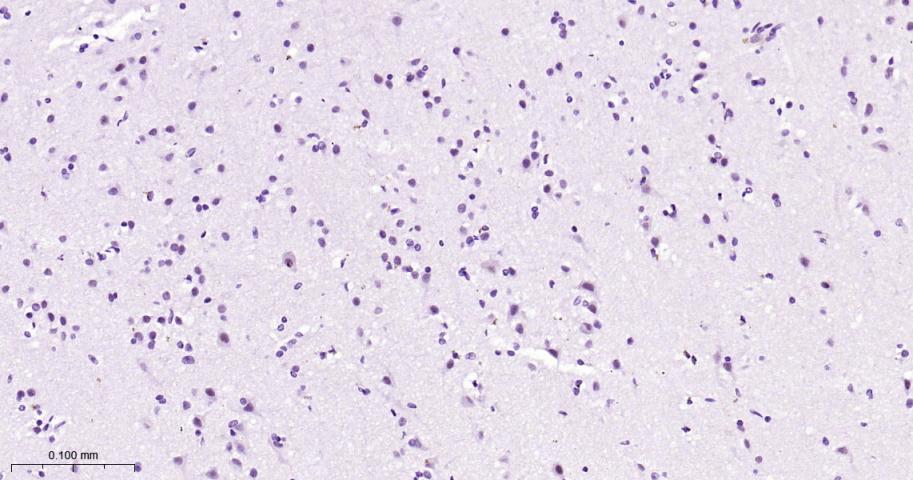 phospho-STAT3 (Tyr705) Mouse m