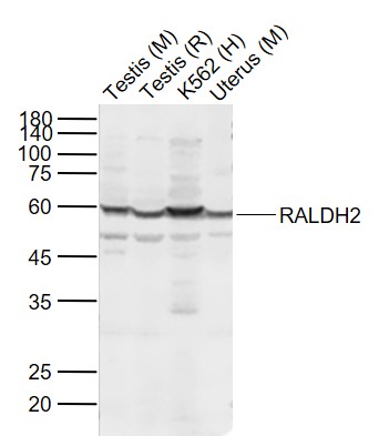 ALDH1A2 Rabbit pAb(bs-3676R)-5