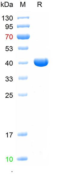 Recombinant human Lck protein