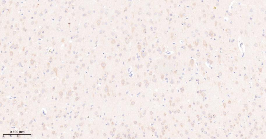 mTOR Recombinant Rabbit mAb(bs