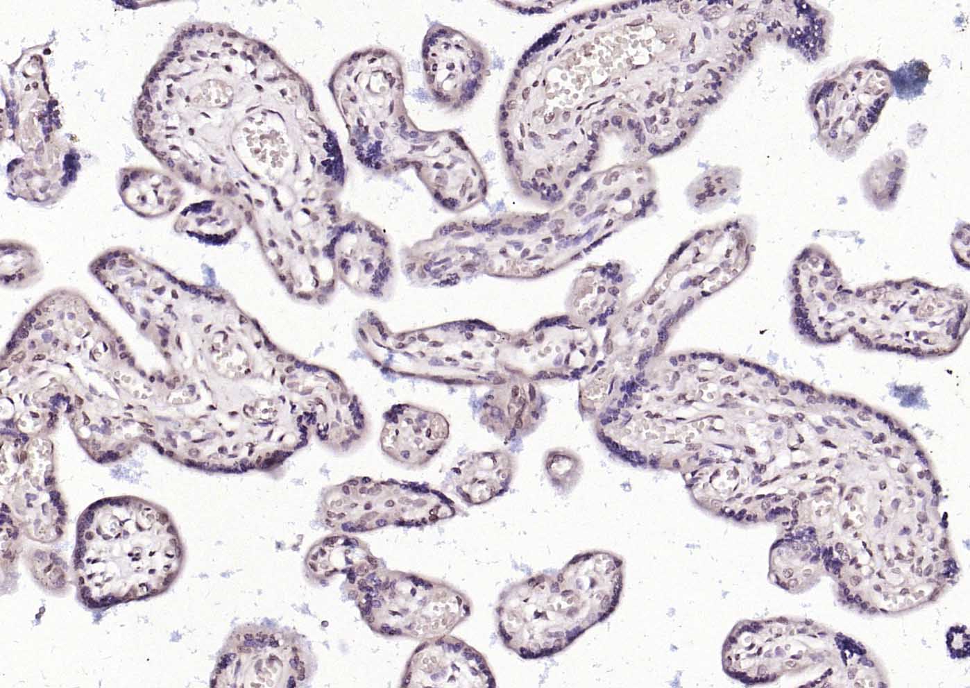 HSF1 Rabbit pAb(bs-3757R)-50ul