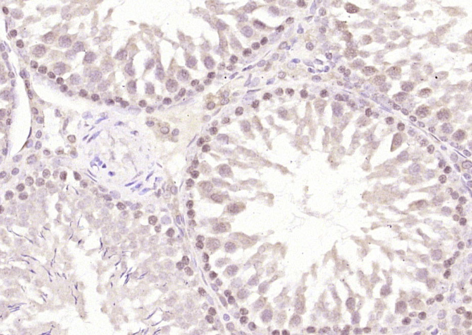phospho-CREM (Ser271 + Ser274)