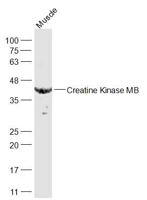 Creatine Kinase MB Rabbit pAb(