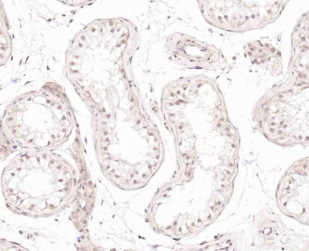 BRMS1 Rabbit pAb(bs-8686R)-50u